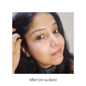 After Image After Using reglora for 2 weeks