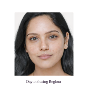 Before 01 Before image 02 user
